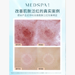 法国美帕MEDSPA壳聚糖修护面膜涂抹冻干粉舒缓提亮 20g*10片
