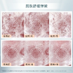 法国美帕青春油3ml轻盈养肤抗初老精华油修护滋养抗皱保湿不油腻
